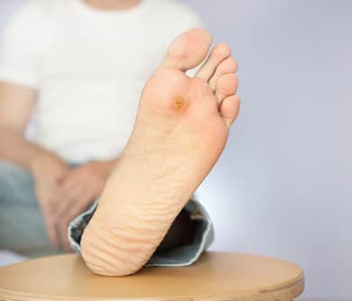5 Ways to Prevent a Diabetic Foot Ulcer - DFW Foot and Ankle Care - Dr.  Zubeen Mistry